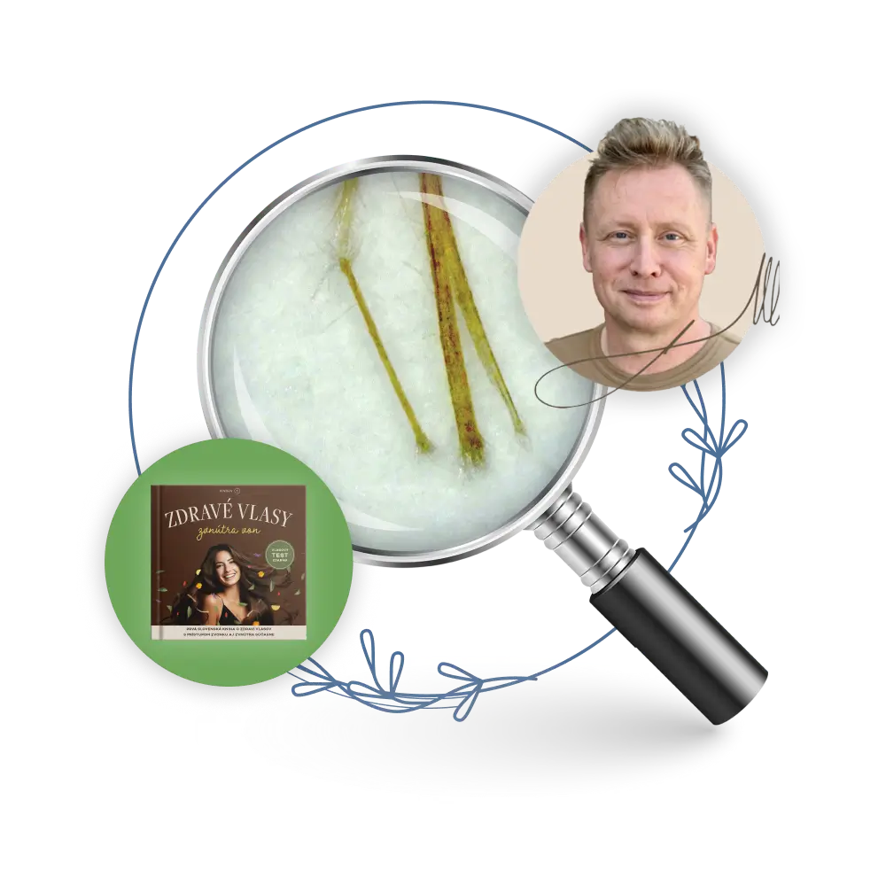 TRICHOLOGICKÁ ANALÝZA